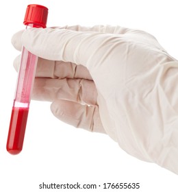 Hand With Latex Glove Holding Blood Sample Vial Isolated On White Background