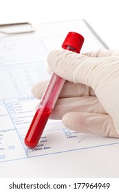 Hand With Latex Glove Holding Blood Sample Vial In Front Of Blood Test Form