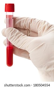 Hand With Latex Glove Holding Blood Sample Vial Isolated On White Background