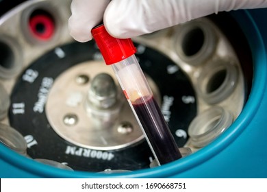 Hand With Latex Glove Holding Medical Blood Container With Blood Specimen, Putting In Centrifuge For Blood Spinning.