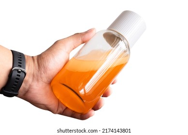 Hand of man holding Thai Boxing Liniment (Namman Muay) use for massage to relieve muscle. - Shutterstock ID 2174143801
