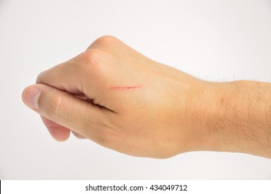 Hand Of A Man With A Small Cut In White Background