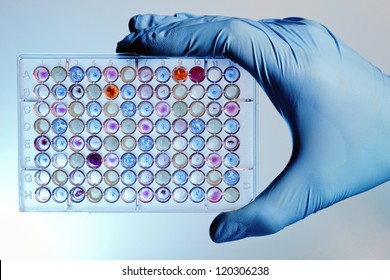 A hand with a microplate filled with color samples