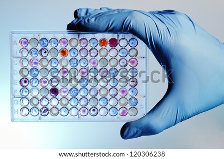 A hand with a microplate filled with color samples