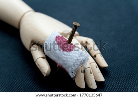 Hand of model with bruised wound