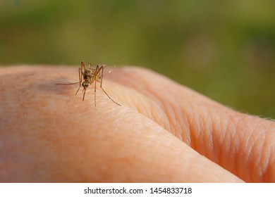 A Hand From A Mosquito Bite. Mosquito Drinks Blood On The Arm.