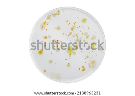 Hand with Petri dish or culture media with bacteria on white background with clipping path, Test various germs, virus, Coronavirus, COVID-19, Microbial population count, Food science.