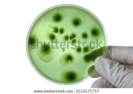 Hand with Petri dish or culture media with bacteria on white background with clipping, Test various germs, virus, Coronavirus, COVID-19, Microbial population count, Food science.