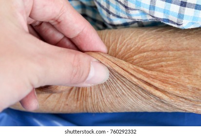 Hand Pinch Skin Of Old Woman