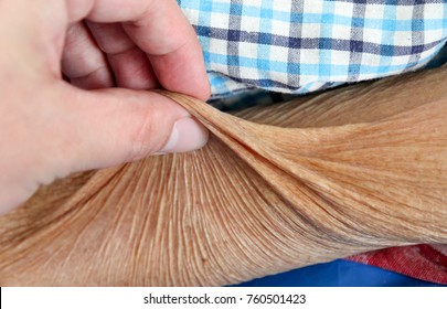 Hand Pinch Skin Of Old Woman, Skin Flexible Test