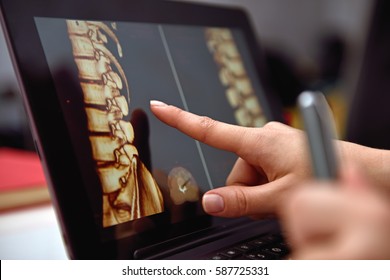 Hand pointing on screen with X-rays of the spine. close up - Shutterstock ID 587725331