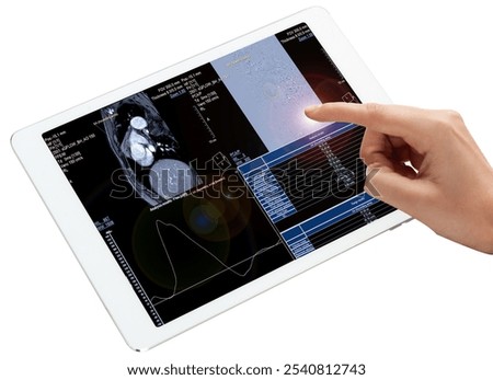 A hand points at a tablet screen displaying an MRI of the heart under stress, with detailed analysis results and graphs isolated on a white background with a clipping path.