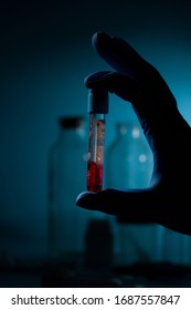 Hand Of Researcher Holds Test Tube With Blood For Coronavirus 2019-nCOV Test. Dramatic Light 