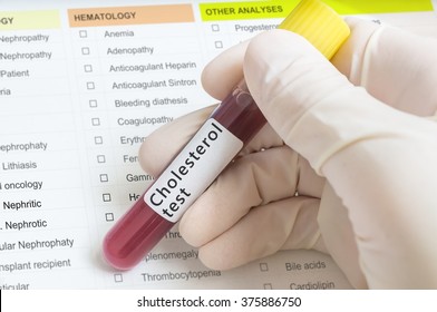 Hand Of Researcher In Laboratory Holds Test Tube With Blood For Cholesterol Test.