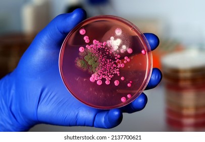 Hand Of A Researcher Showing A Close-up Of A Microbiological Culture Plate With Mold And Yeast