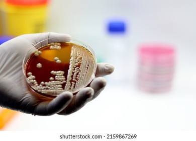 Hand Of A Researcher Showing A Close-up Of A Microbiological Culture Plate With Probiotic Yeasts