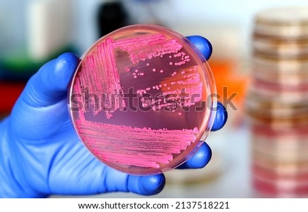 Hand of a researcher showing a close-up of a microbiological culture plate with probiotic yeasts