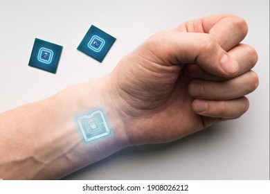 Hand With RFID Chip Implant
