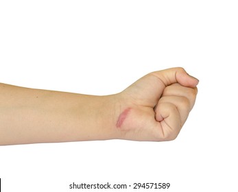 Hand With Scar Isolated On White.