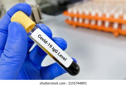 Hand of scientist hold a test tube which is ready for Covid-19 IgG (antibody) test in laboratory.