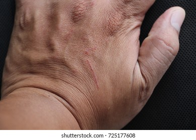 Hand with the scratch on a black background