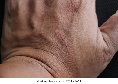 Hand with the scratch on a black background
