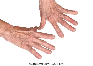 Small White Spots On Skin Senior Stock Photo (Edit Now) 1923029069