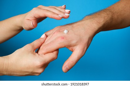 Hand Skin Care. The Woman Put The Cream On Man's Weathered Hand.