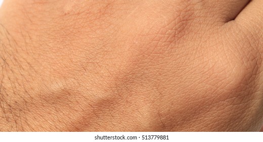 hand skin texture