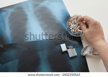 Hand of smoker extinguishes cigarette butt in ashtray full of cigarette butts, with x-ray of lungs in the background. Cigarette and nicotine addiction, lung diseases in smokers