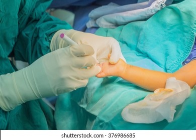 Hand Surgery In Syndactyly Children