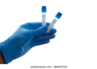 Hand With A Test Tube On A White Background, Coagulation Sodium Citrate