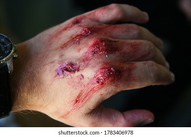 Hand Schnittwunde Blut aus