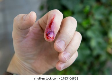 Hand Schnittwunde Blut aus