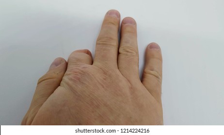 Fingers Merely
