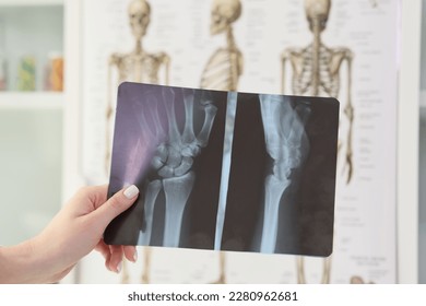 Hand of woman holding x-ray of wrist against skeletons in doctor office. Professional checkup of condition of bones and joints in hospital closeup - Shutterstock ID 2280962681