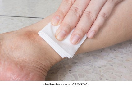 Hand of woman is pressing gauze bandage on leg to stop wound bleeding , selective focus