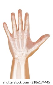 Hand and wrist x-ray lateral view ,Medical image concept on white background. - Shutterstock ID 2186174445