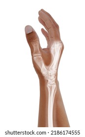 Hand and wrist x-ray Oblique view,Medical image concept. - Shutterstock ID 2186174555
