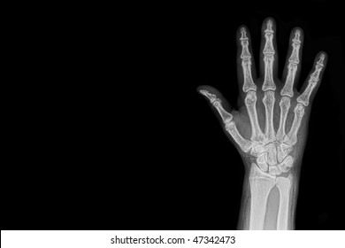 Hand X-ray background - Shutterstock ID 47342473