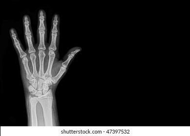 Hand X-ray background - Shutterstock ID 47397532