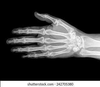 Hand Xray Image Medical Background