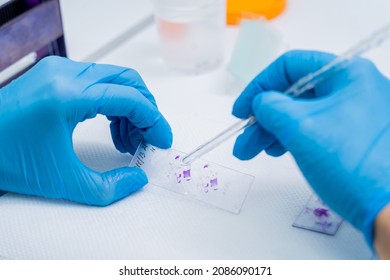 Hands In Blue Glove Holding Glass Histology Slides