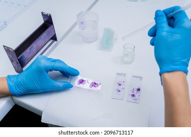 Hands in blue glove holding glass histology slides - Shutterstock ID 2096713117