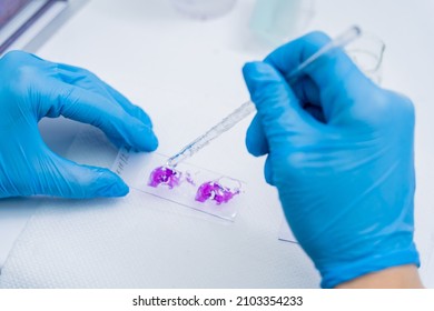 Hands In Blue Glove Holding Glass Histology Slides