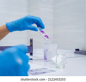 Hands In Blue Glove Holding Glass Histology Slides