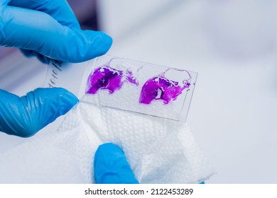 Hands In Blue Glove Holding Glass Histology Slides