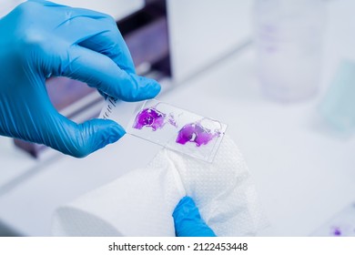 Hands in blue glove holding glass histology slides
