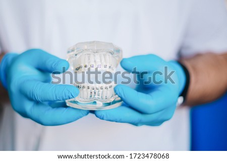 The doctor’s hands in blue gloves hold an artificial model of the jaw with breaks. The dentist shows an example of tooth alignment. Tooth plates