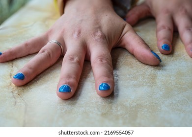 Hands With Blue Nail Polish Of A 35 Year Old White Woman